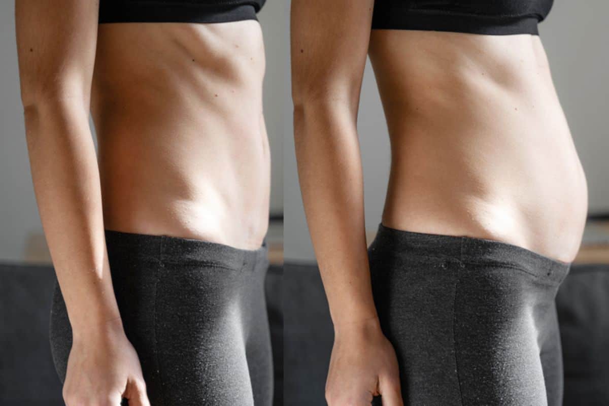 How long does diastasis recti take to improve World's End?