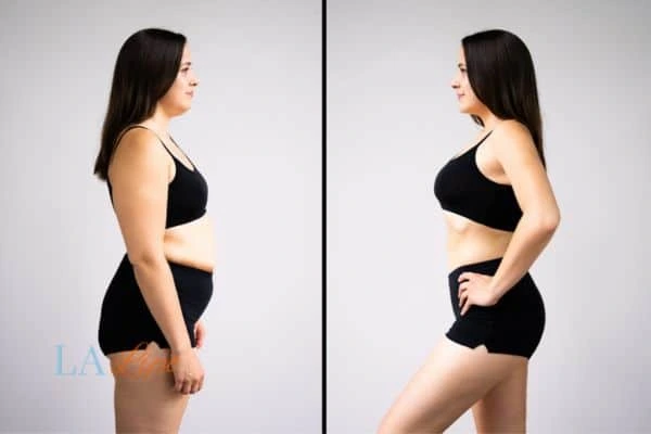 LA-EMS Body Sculpting World's End results before and after of womans results on body toning.