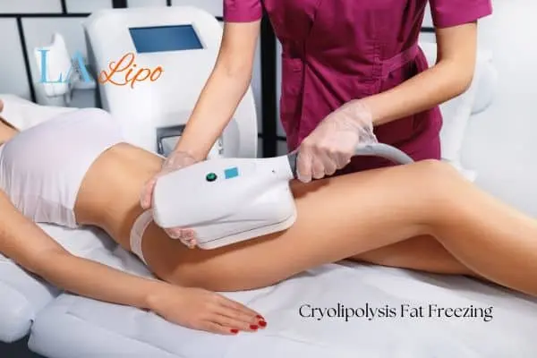 Woman receiving coolsculpting World's End treatment on her thighs