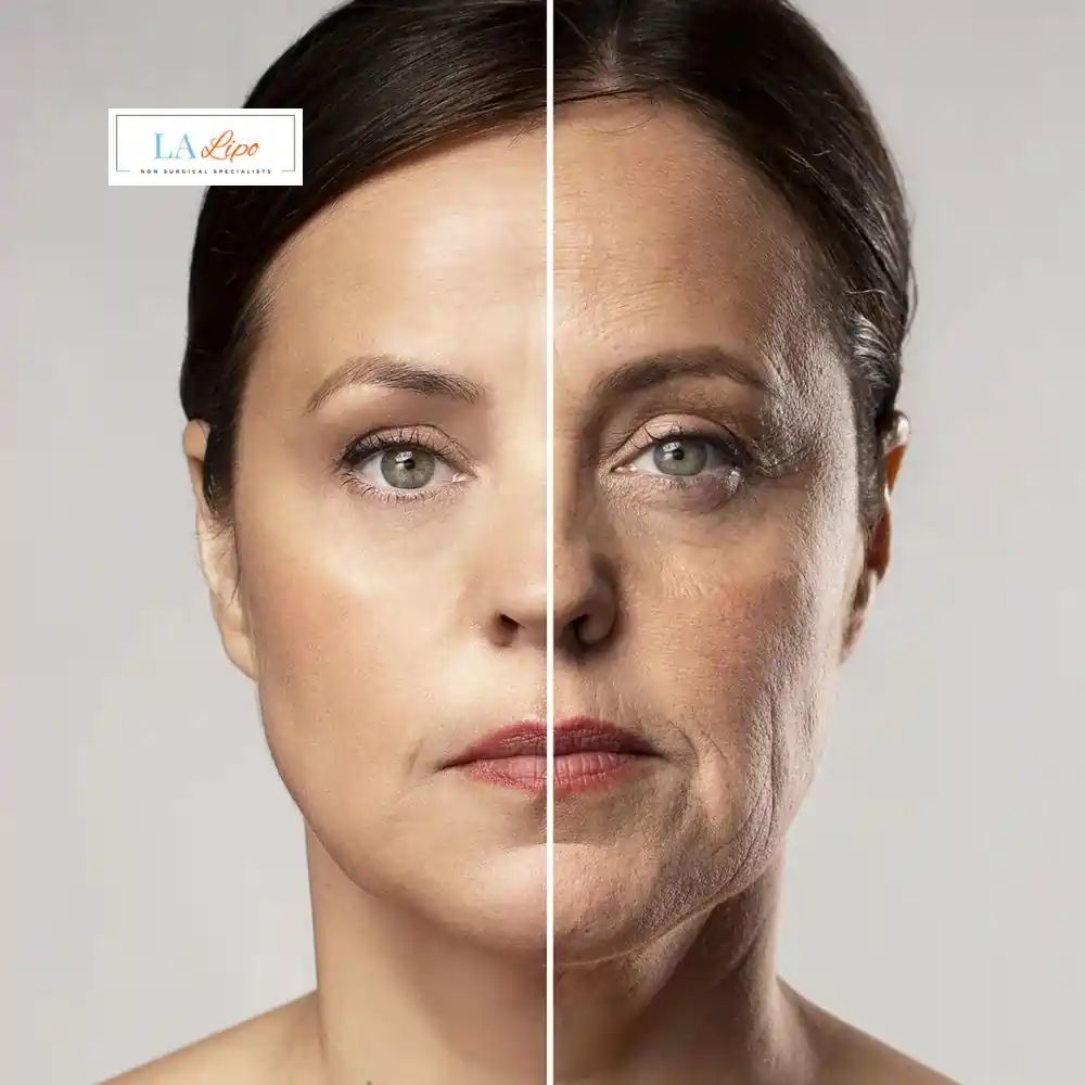 How Can You Tell If Non-Surgical Skin Tightening Is Right for You World's End?