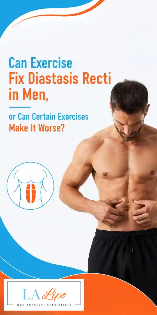 Can Exercise Fix Diastasis Recti in Men, or Can Certain Exercises Make It Worse World's End?